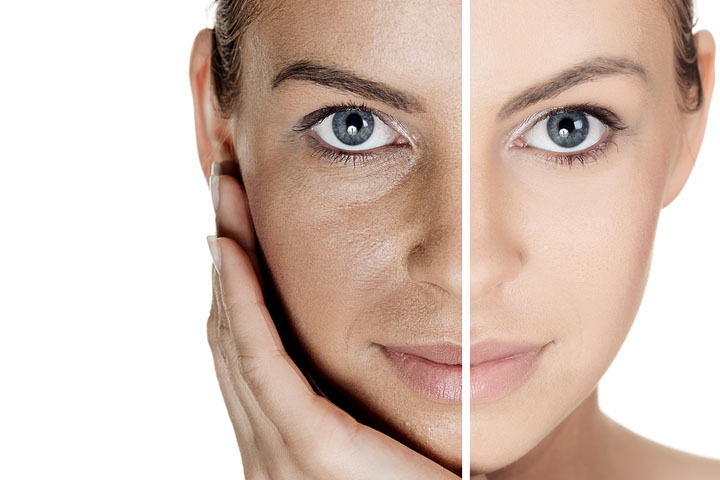 Is changing season making your skin dry and dull?